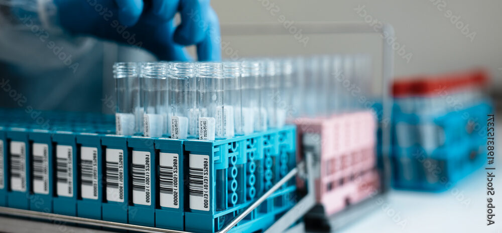 A gloved hand arranges a row of test tubes in an iso 17025 accredited consumer products testing laboratory